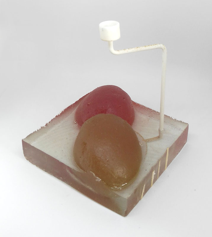 The twins / Les jumelles